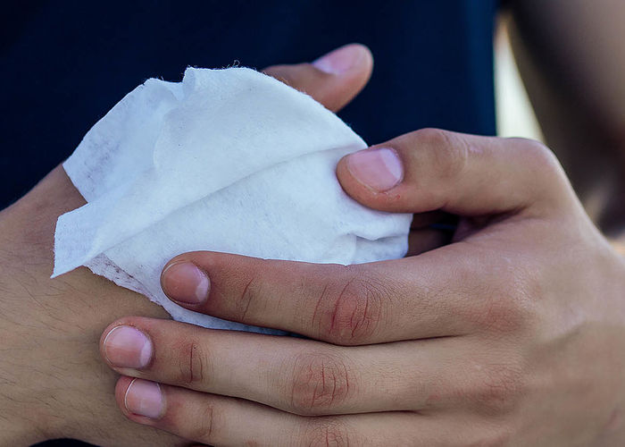 Nadpotliwość dłoni